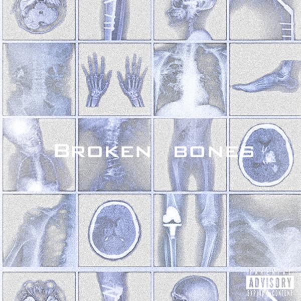 Альбом broken bones исполнителя Seon